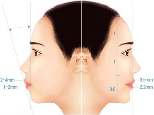 Những dạng cằm nên tránh ở phụ nữ