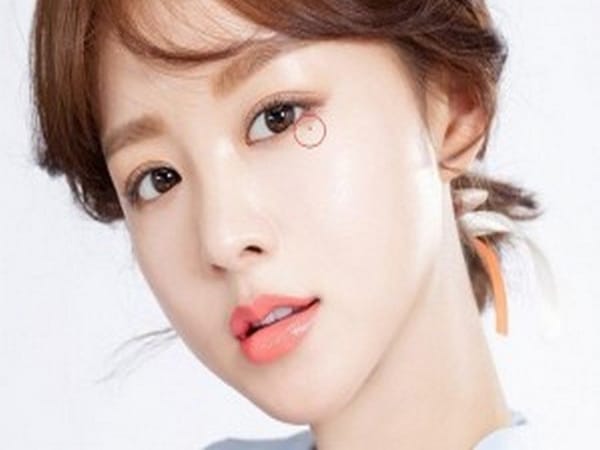 Nốt ruồi dưới mắt nói lên điều gì?