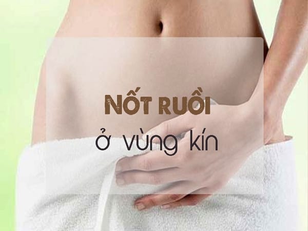 Nốt ruồi ở thân thể