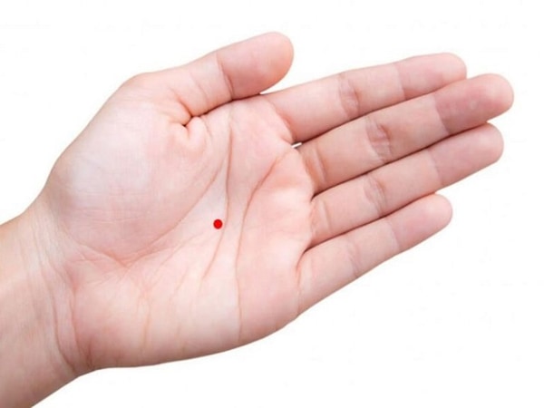 Nốt ruồi son trong lòng bàn tay ở nữ giới