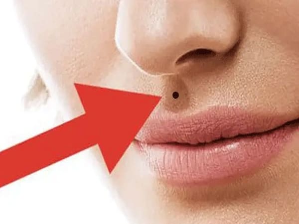 Xem tướng nốt ruồi nhân trung theo từng vị trí