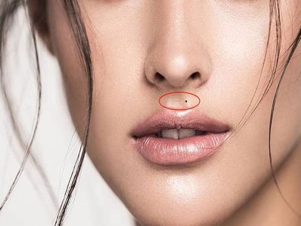 Ý nghĩa của nốt ruồi nhân trung