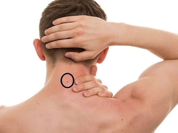 Ý nghĩa chung của nốt ruồi sau gáy