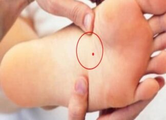 Nốt ruồi dưới lòng bàn chân ở nam và nữ là dấu hiệu phú quý tài lộc nốt ruồi dưới lòng bàn chân