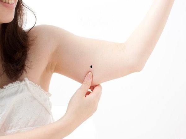  Nốt ruồi ở mặt trong bắp tay phải