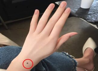 Nốt ruồi ở cổ tay trái, phải nam và nữ nói lên điều gì