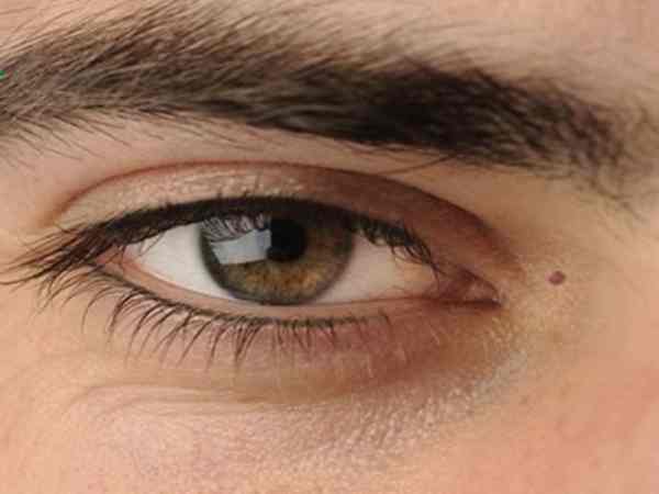 Nốt ruồi khóe mắt phải nam Nốt ruồi khóe mắt phải nam