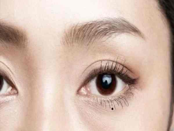 Nốt ruồi dưới mí mắt trái nữ Nốt ruồi dưới mí mắt trái nữ