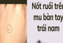 Ý nghĩa nốt ruồi mu bàn tay phải và trái ở nam nữ chuẩn nốt ruồi mu bàn tay